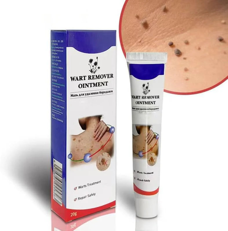 Advanced Cryogenic Warts Remover – Clinic Grade