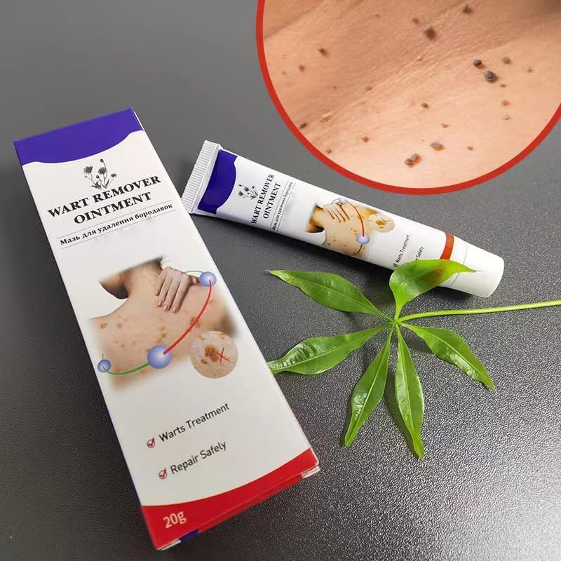 Advanced Cryogenic Warts Remover – Clinic Grade