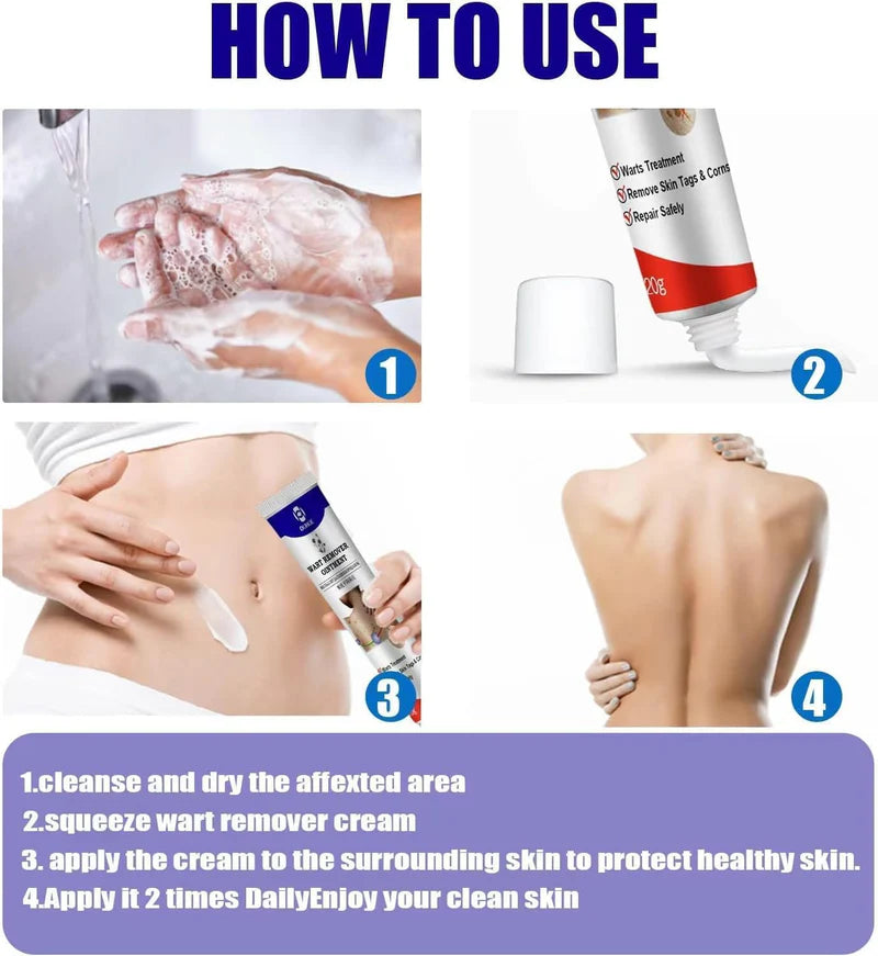 Advanced Cryogenic Warts Remover – Clinic Grade