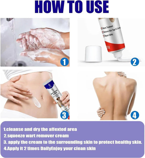 Advanced Cryogenic Warts Remover – Clinic Grade